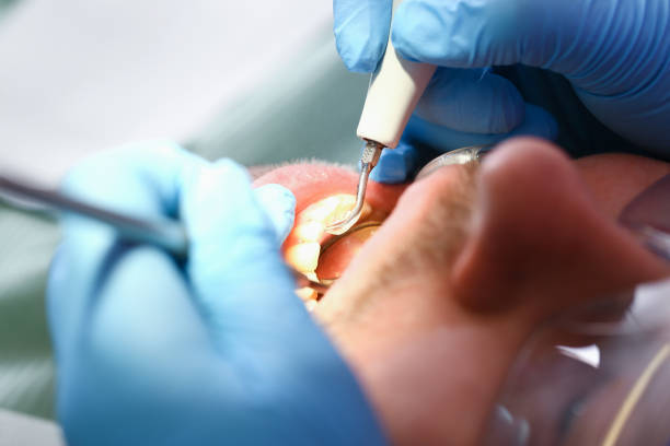 Best Urgent Dental Care for Toothache in Vinings, GA